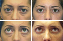 Before & After Photos